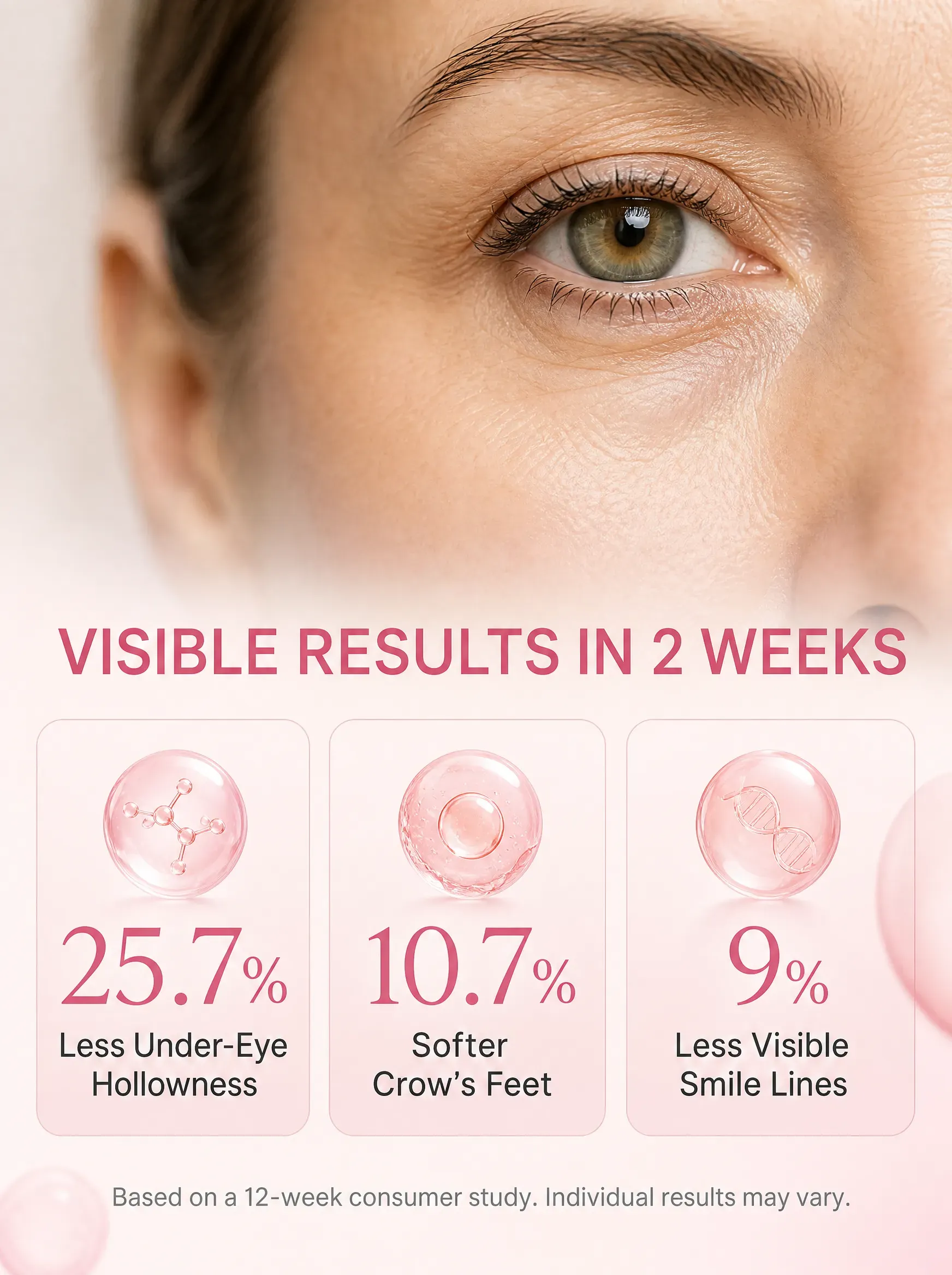 Under-eye structure diagram