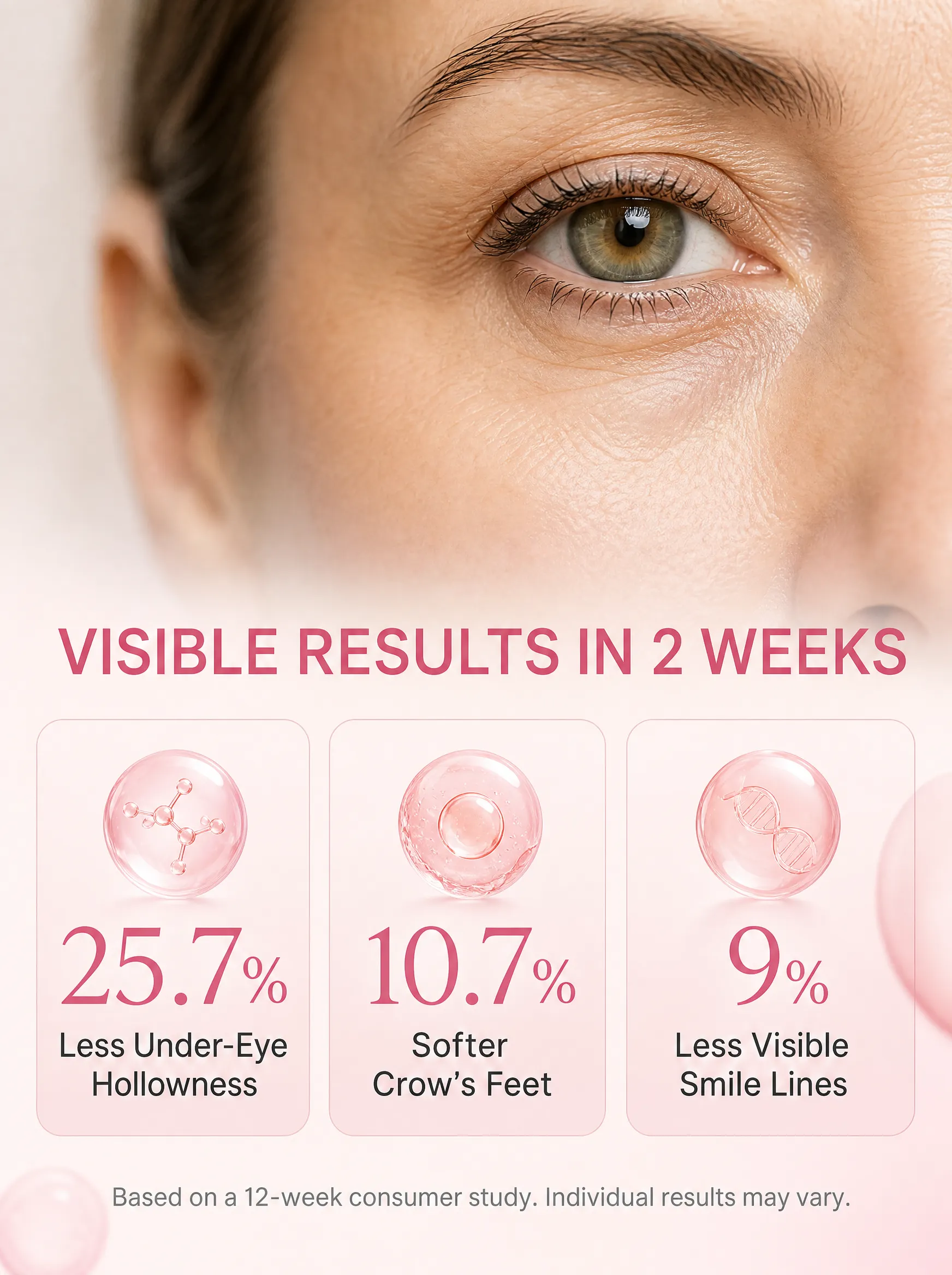 Under-eye structure diagram